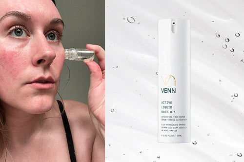Most Derms Don't Recommend DIY Microneedling—Luckily, These 3 Alternatives Are Just as Effective