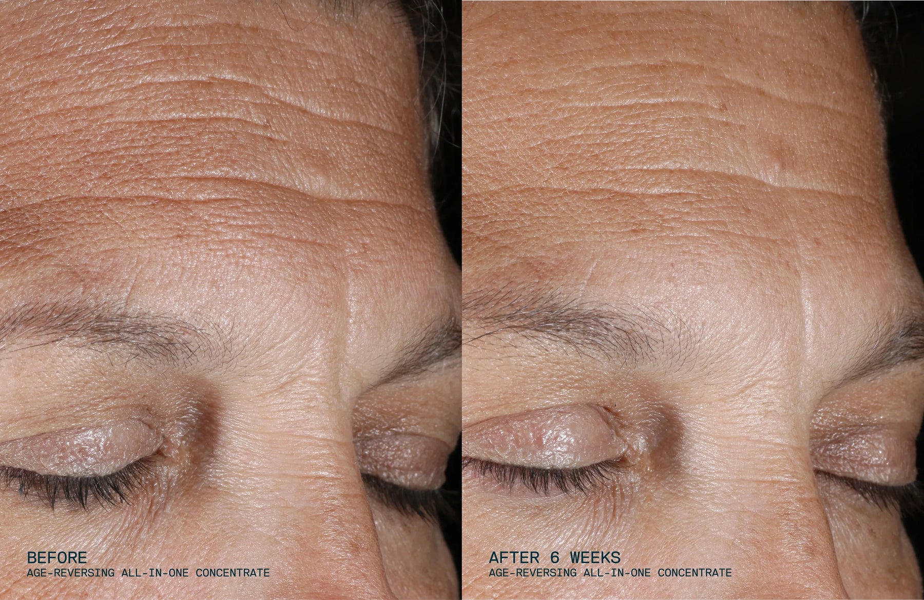 Before and after comparison of eye area skin texture with a skincare product.